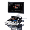 GE Healthcare Logiq P7