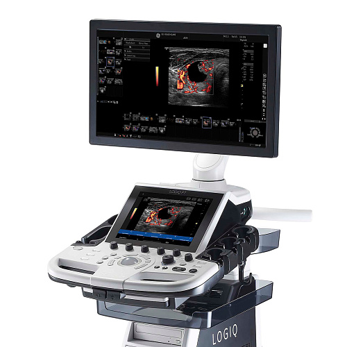 GE Healthcare Logiq P7