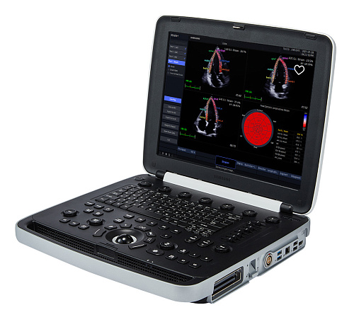 Samsung Medison HM70 EVO