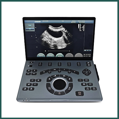 CHISON SonoAir 