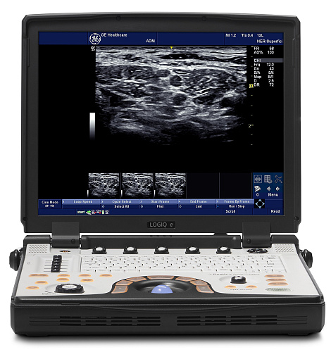 GE Healthcare Logiq E