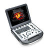Mindray M6