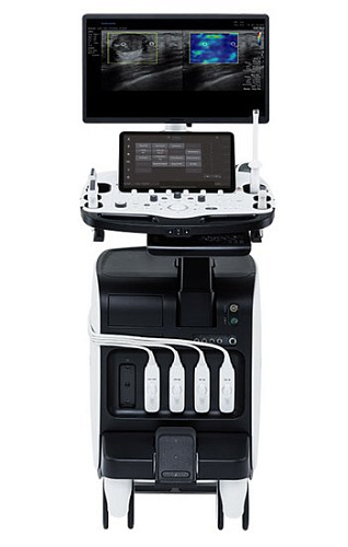 Samsung Medison RS85