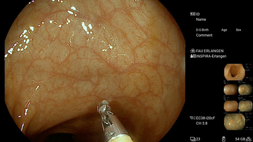 Pentax EPK-i8020с Inspira