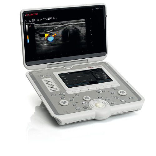 Esaote S.p.A  MyLab Sigma
